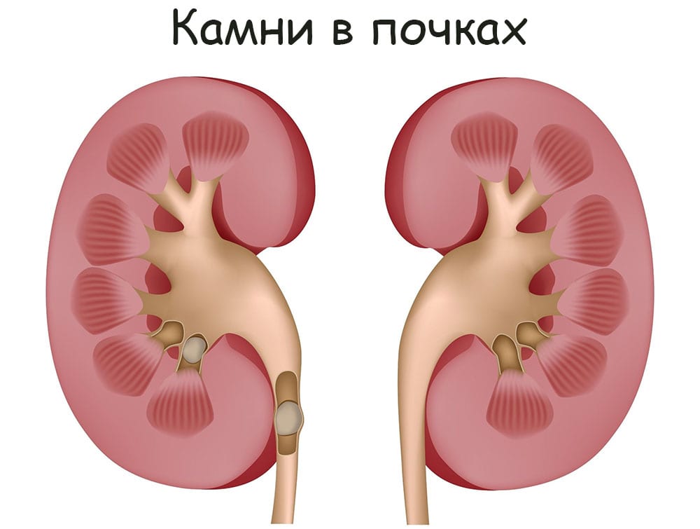 Кракен магазин тор